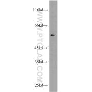 V5-tag Rabbit Polyclonal Antibody (14440-1-AP)