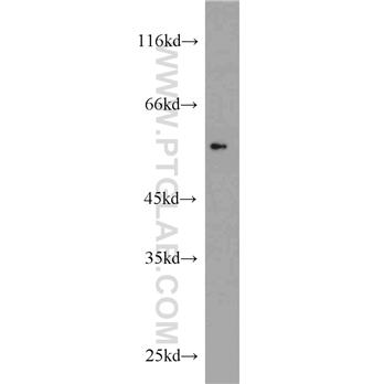 V5-tag Rabbit Polyclonal Antibody (14440-1-AP)