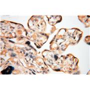 HPS5 Rabbit Polyclonal Antibody (13901-1-AP)