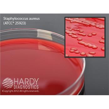 Blood Agar Plate, 5% Sheep Blood in Tryptic Soy Agar (TSA) Base