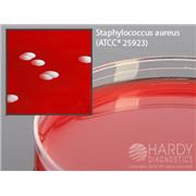 PEA (Phenylethyl Alcohol Agar) with 5% Sheep Blood
