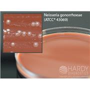 Thayer Martin Modified Agar