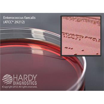 EMB Levine Agar (Eosin Methylene Blue)