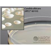 Emmon's Sabdex (Sabouraud Dextrose) Agar