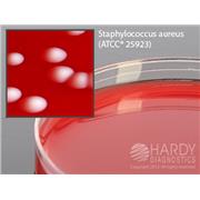 Columbia Blood Agar with 5% Sheep Blood