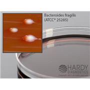 LKV (Laked Sheep Blood, Kanamycin, Vancomycin) Agar
