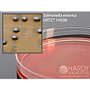 SS (Salmonella Shigella) Agar
