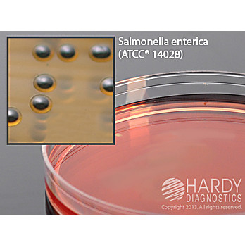 SS (Salmonella Shigella) Agar