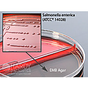 Blood Agar, 5%/EMB Agar Biplate