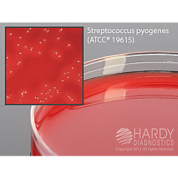 Selective Strep Agar (COBA Medium)