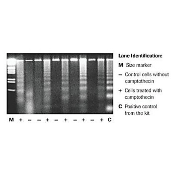 ROCHE Apoptotic DNA-Ladder Kit
