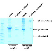 Pearl™ Antibody Clean Up Kit