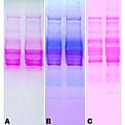 Glycoprotein Staining