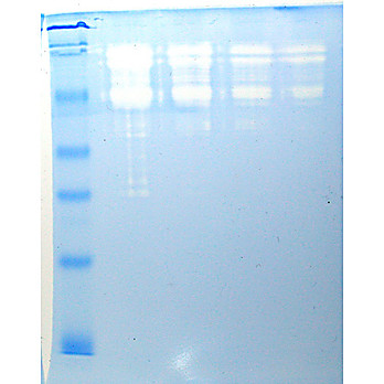 Zymogram: Study of an Active Enzyme with Electrophoresis Kit