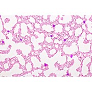 Wright's Giemsa Stain