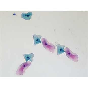 Pap Stain, OG-6