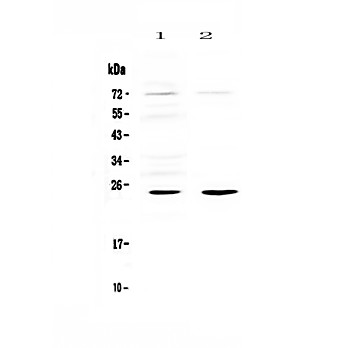 Anti-IL6 Picoband™ Antibody