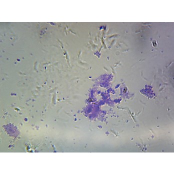 Prepared Microscope Slide,Streptococcus (Diplococcus) Pneumonia 