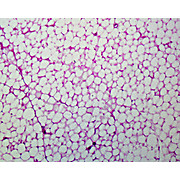 Prepared Microscope Slide,Adipose Tissue Section, Human