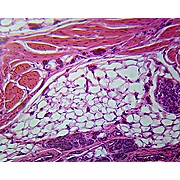 Prepared Microscope Slide: Integumentary Tissues, Human Skin, C.S.