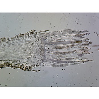 Prepared Microscope Slide,Moss Archegonia L.S.