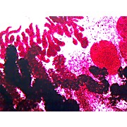 Prepared Microscope Slide,Zoology; Clonorchis Sinenis W.M. , Human Liver Fluke