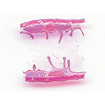 Prepared Microscope Slide, Earthworm 9-16 Segment L.S. Sex Organ  