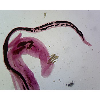 Prepared Microscope Slide, Ancylostoma Duodenale Female W.M.
