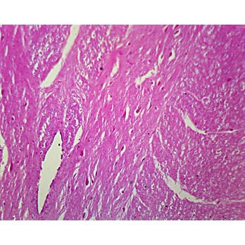 Prepared Microscope Slide,Spinal Ganglion and Nerve