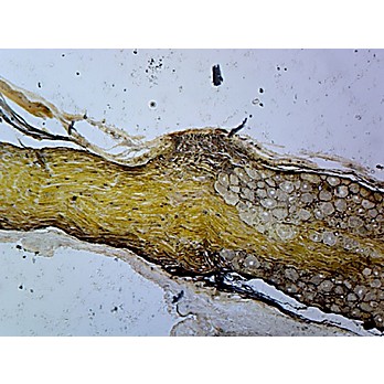 Prepared Microscope Slide,Golgi Complex Spinal Ganglion Organelle