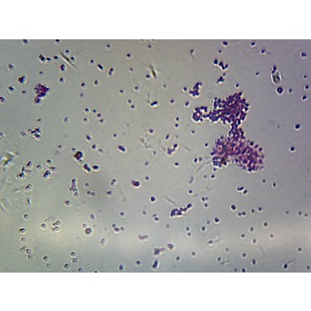 Prepared Microscope Slide,Diplococci Neisseria & Enterococcus 