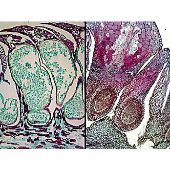 Prepared Microscope Slide,Pine Life, Root, Stem, Leaf, Cones L.S.