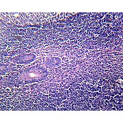 Prepared Microscope Slide,Vermiform Appendix Section
