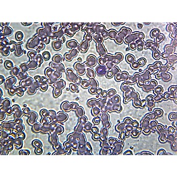 Prepared Microscope Slide,Iron-deficient Anemia Blood Smear 