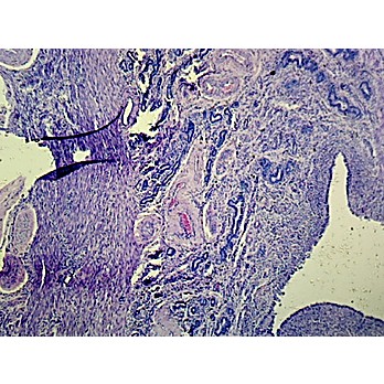 Prepared Microscope Slide,Female Uterus Progravid Secretory Phase