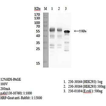 Rabbit anti-SARS-CoV-2 N-Protein