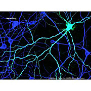 Neuromag