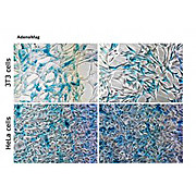 Adenomag
