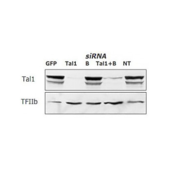Silencemag Transfection Reagent