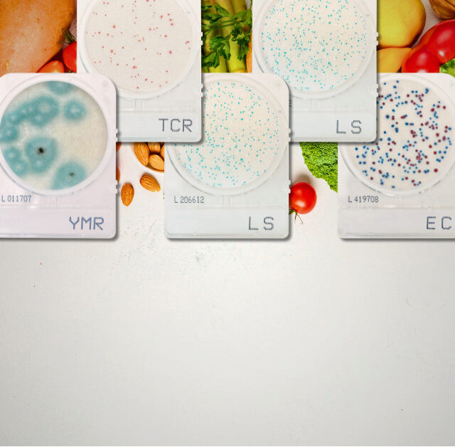 Effortless colony counting and enumeration for food safety.